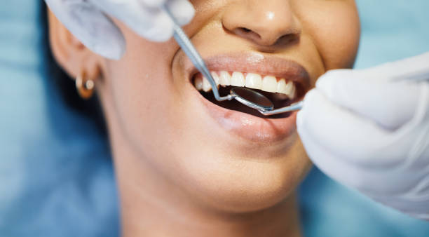 Best Emergency Dental Care for Sports Injuries in Ross, OH
